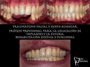 Odontología Implantología, Prostodoncia Y Estética En