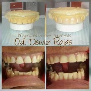 Servicio De Odontología General Od. Deiviz Rojas