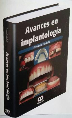 Libro (Fernando Pedrola) Avances En Implantología.