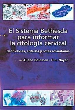 Sistema Bethesda Para Informar La Citologia Cervical ()