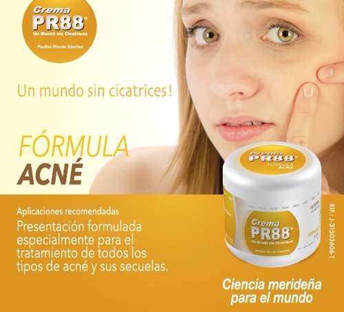 Pr88 Acne