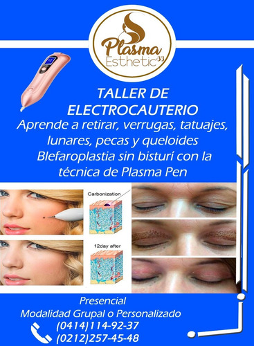 Curso Plasma Rico En Plaquetas Y Plasma Gel. Plasma Pen