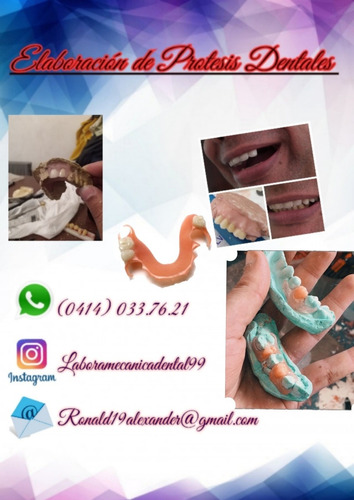 Prótesis Dental