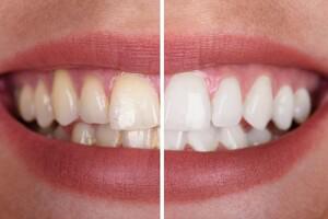 Clinica dental korso y tecnica dental